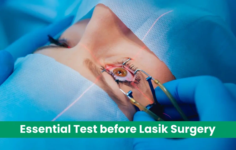 Essential Test before Lasik Surgery